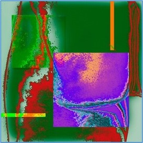 UIt women solarisatie